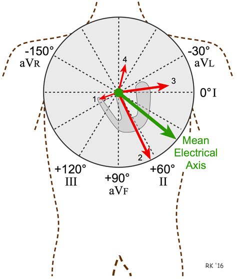 net electrical axis